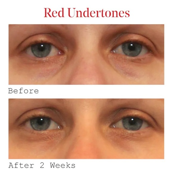 Murad Environmental Shield Vita-C Dark Circle Corrector .5oz - Picture 5 of 7